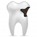 Denti neri cariati