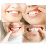 Dolore gengiva sopra dente