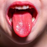 Febbre da denti