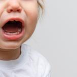 Gengive gonfie bambini 1 anno