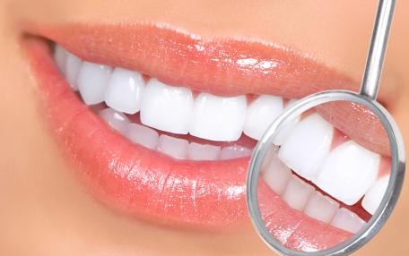 Smalto per denti