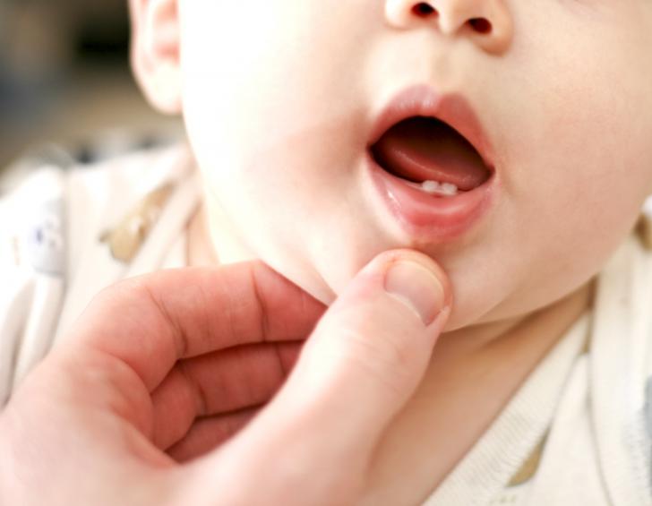 Mal di denti neonati Mal di denti neonati
