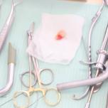 Dente provvisorio dopo estrazione