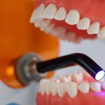 Denti fissi in resina