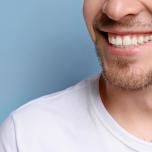 Denti in resina quanto durano