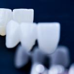 Denti provvisori danno fastidio