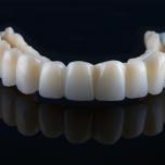 Denti provvisori