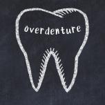 Overdenture