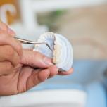 Pontefix per denti