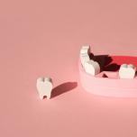 Riempitivi dentali temporanei