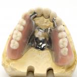 Scheletrato dentale