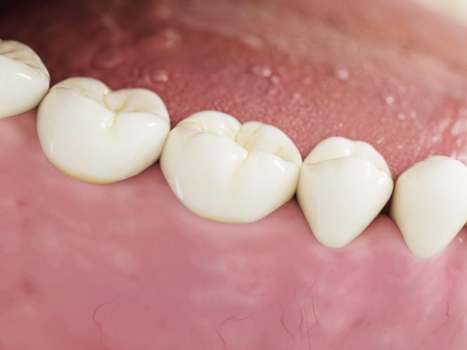 Cemento provvisorio denti quanto dura Cemento provvisorio denti quanto dura