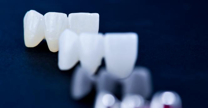 Denti provvisori danno fastidio Denti provvisori danno fastidio