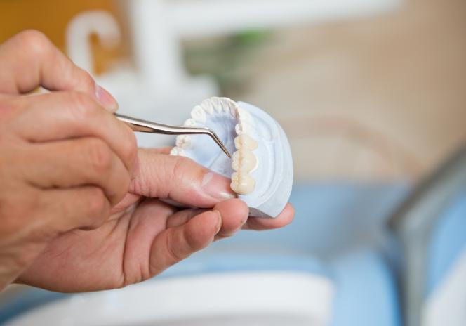 Pontefix per denti Pontefix per denti