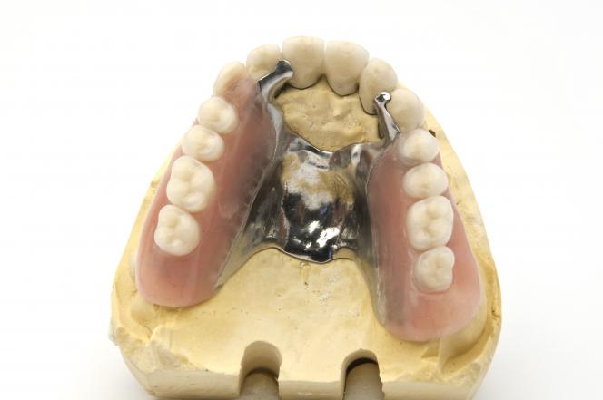 Scheletrato Dentale Vantaggi Della Protesi Dentale Scheletrata scheletrato-dentale-vantaggi-della-protesi-dentale-scheletrata