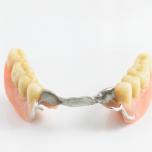 Dentiera inferiore si muove