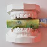 Quanto costa una dentiera