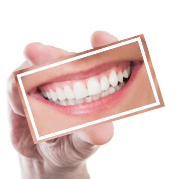 Dentiera finta
