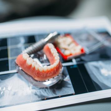 Dentiera mobile