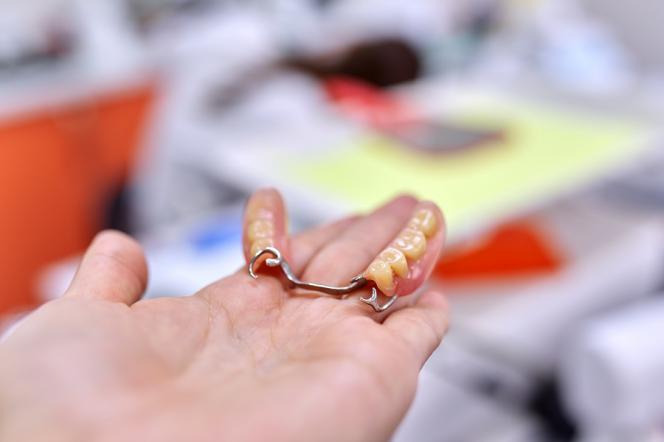 Arcata dentale superiore prezzi Arcata dentale superiore prezzi