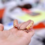 Arcata dentale superiore prezzi