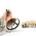 Costo impianto dentale