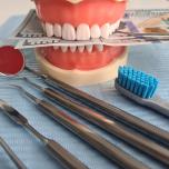 Costo impianto dente molare