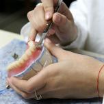 Dente finto provvisorio