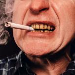 Fumare dopo intervento implantologia