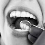 Guancia gonfia dopo impianto dentale