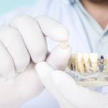 Impianto dentale corto 