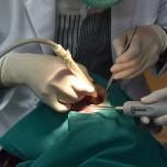 Impianto dentale dolore post operatorio