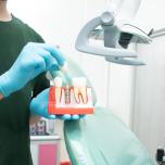 Migliori impianti dentali