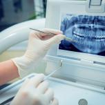 Perimplantite