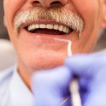 Quanto costa mettere un dente fisso