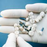 Ricostruzione dente devitalizzazione con perno costo
