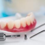 Vite di guarigione impianto dentale
