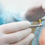 Vite impianto dentale
