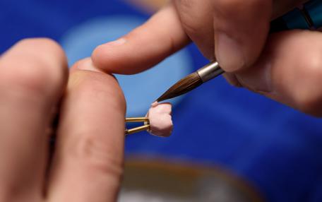 Impianti dentali in zirconio