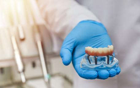 Impianto dentale come funziona