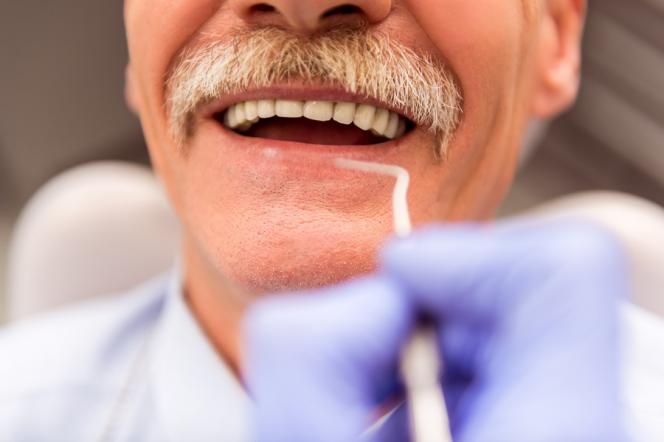 Quanto Costa Mettere Un Dente In Romania