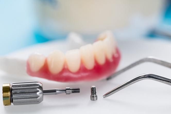 5 Pilastri Di Guarigione Dentale Per Impianti Adin UNP/SP - Monouso, Cina