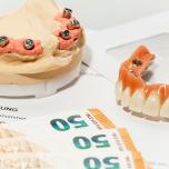 Costo ponte dentale in zirconio