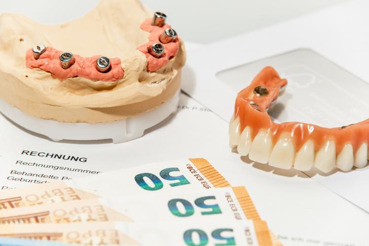 Costo ponte dentale in zirconio Costo ponte dentale in zirconio