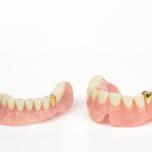 Faccette dentali costo Albania