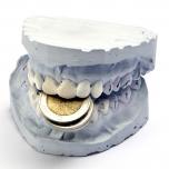 Rifarsi i denti in Marocco