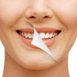 Sbiancamento denti Albania