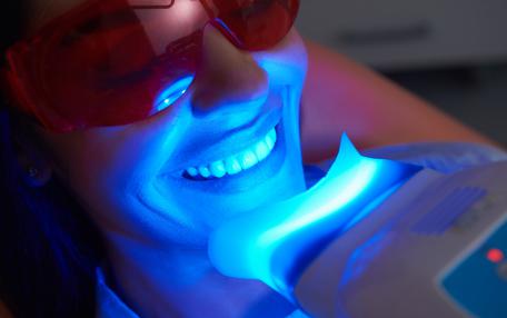Sbiancamento denti Albania